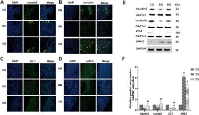 Da-Cheng-Qi decoction improves severe acute pancreatitis capillary leakage syndrome by regulating tight junction-associated proteins